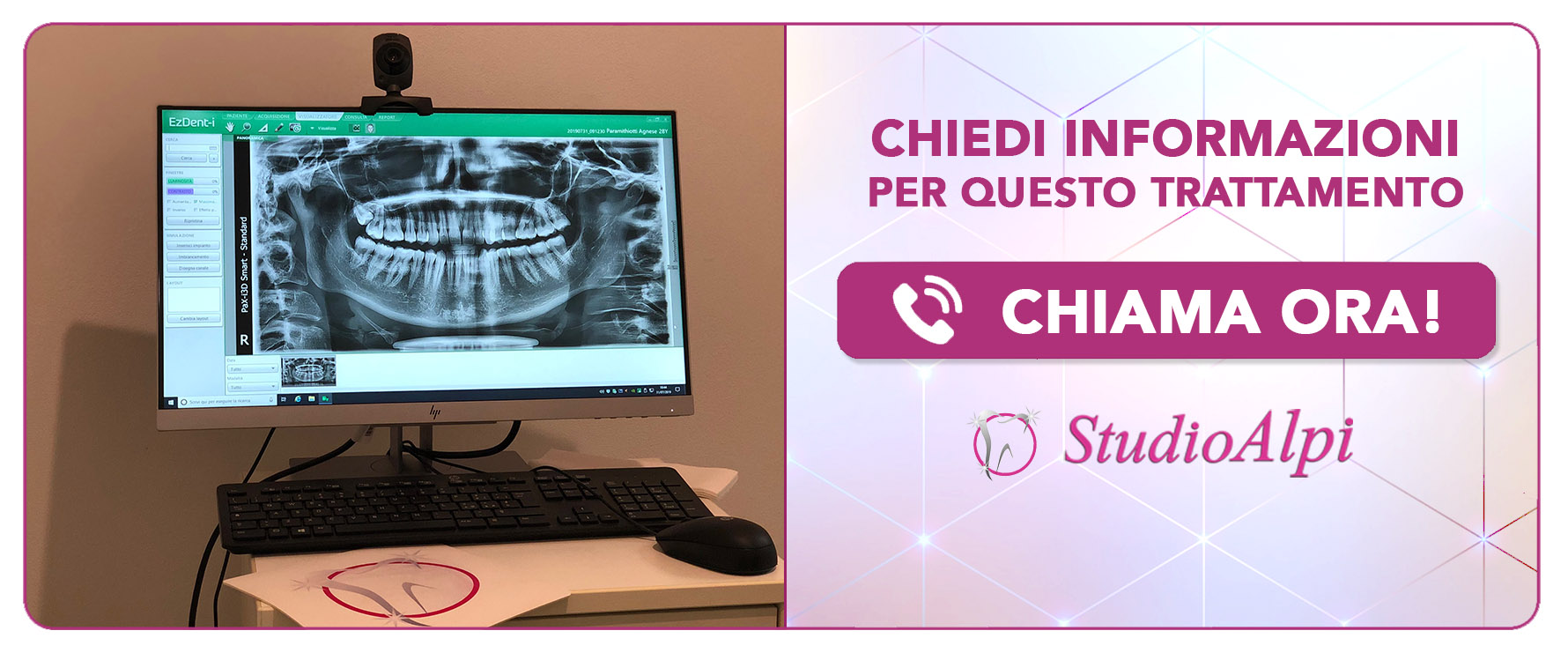 implantologia-computer-guidata a Scandicci (Firenze)